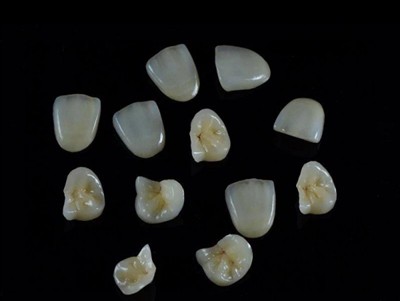 Hoe u de beste tandlijm voor kronen kiest: een nieuwste gids