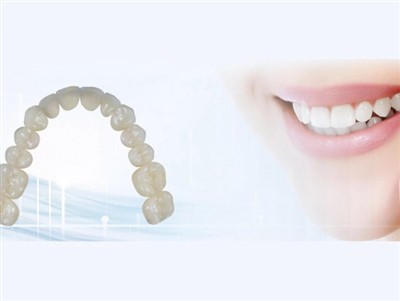 Outsourcing van tandheelkundige laboratoria: voordelen, nadelen en belangrijk...