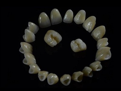 Dental Lab Zirconia-kronen: kwaliteit, proces en waar u op moet letten in een...