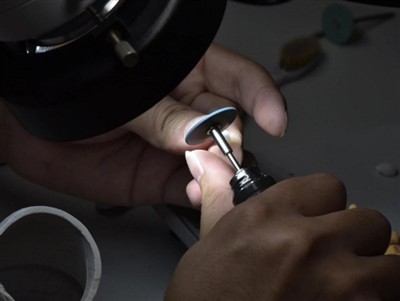 Hoe lang gaan PFM-kronen mee? Gemiddelde levensduur, factoren en verzorgingstips