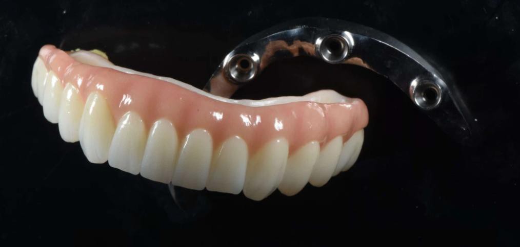 info-1014-483 info-1014-483